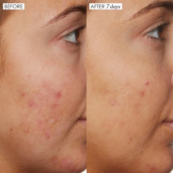 Sunday Riley B3 Nice 10% Niacinamide Serum Full Size - Picture 3 of 9